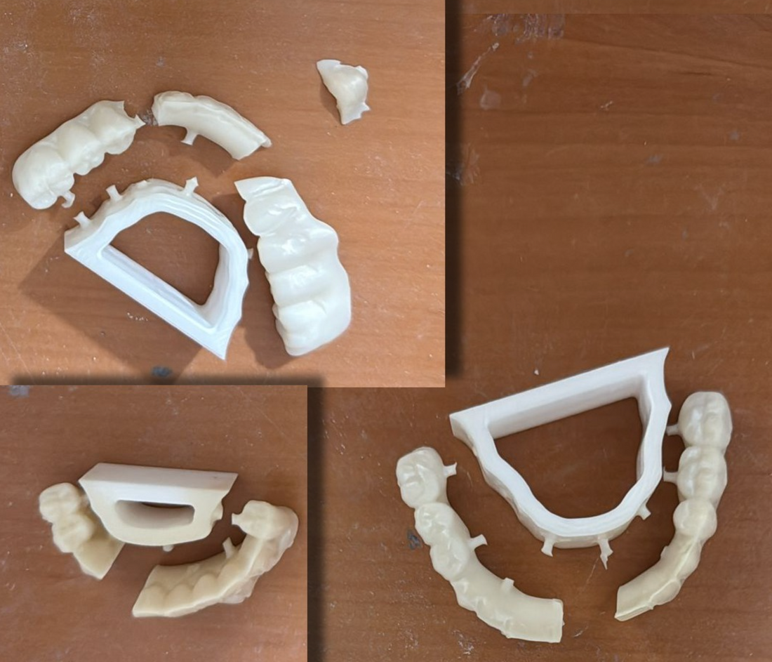 Sinter Ustalarına Yeni Bir Soru: “Niçin Çatladı?