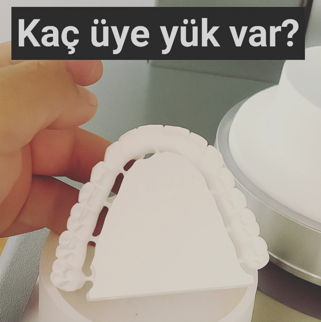 Kaç Üyelik Yük Var?" Sorusuyla Zirkonya Dünyasında Kafa Karıştıran Paylaşım